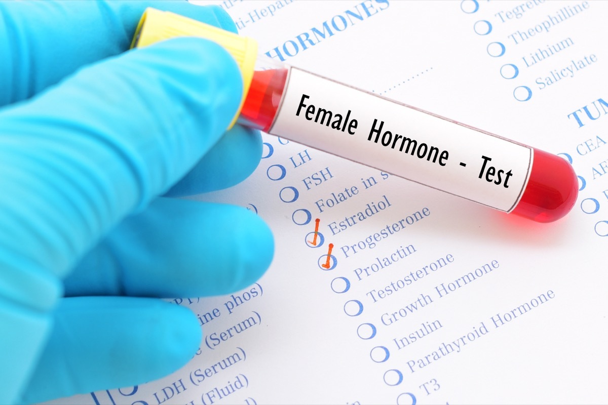 hormone test