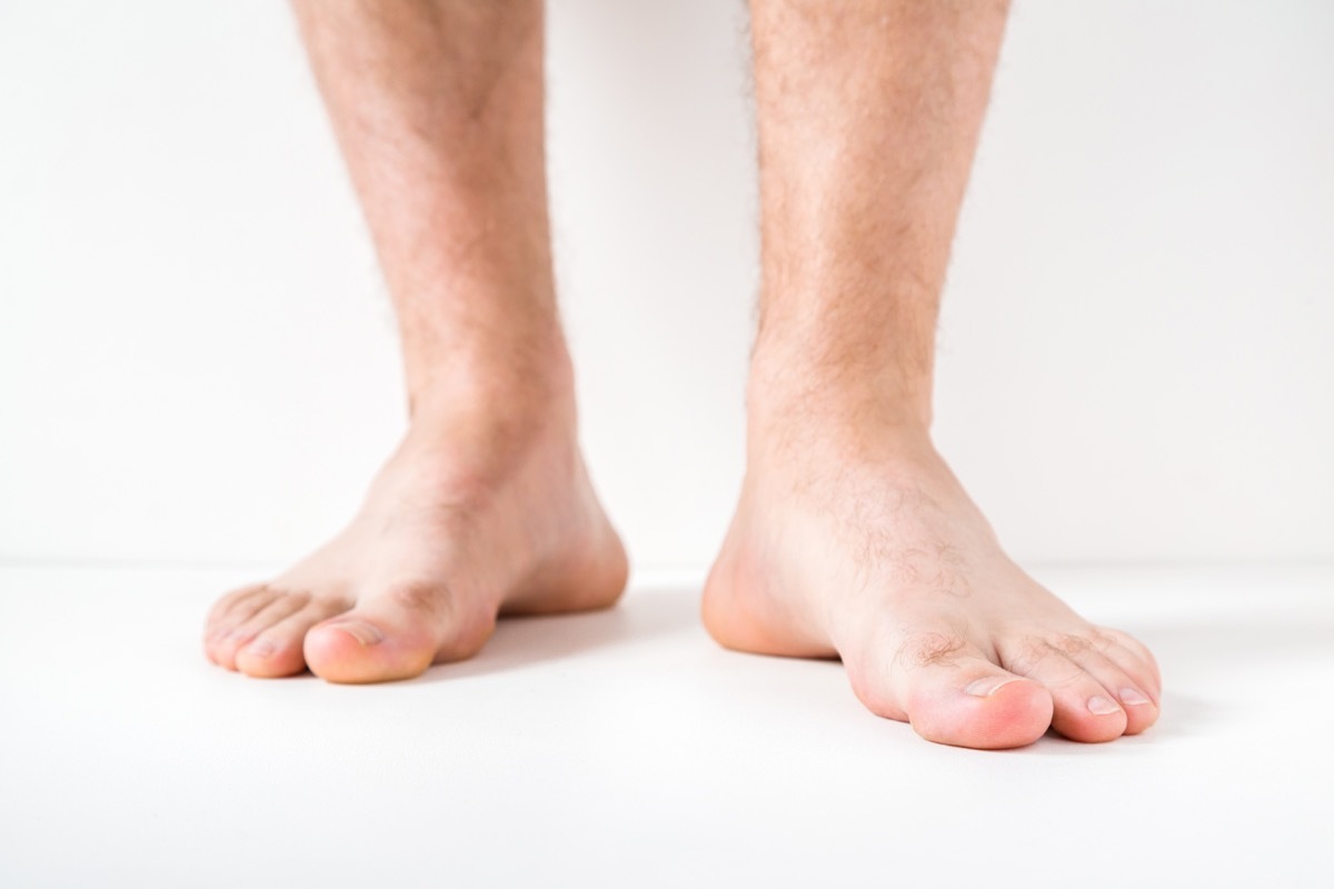 man's feet, subtle symptoms of serious disease