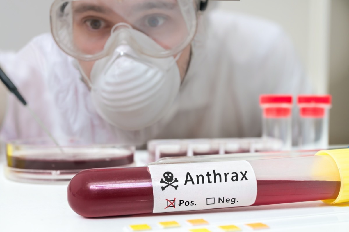 Scientist is analyting blood sample for Anthrax.