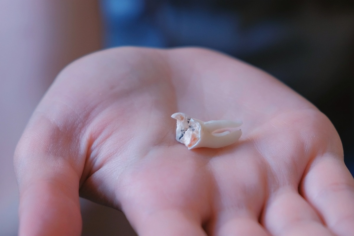 Root of the big tooth in the woman's hands