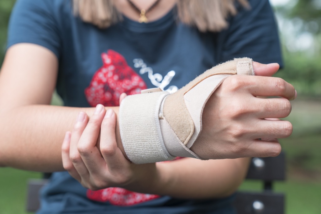 Woman with cast on wrist