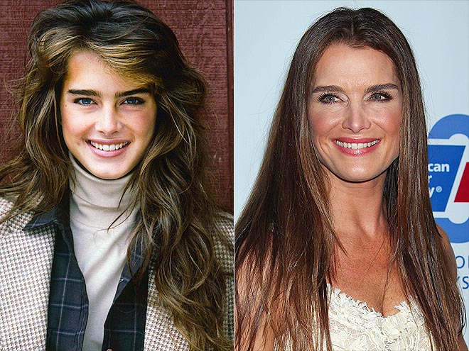 gorgeous-stars-before-and-after-botox-07