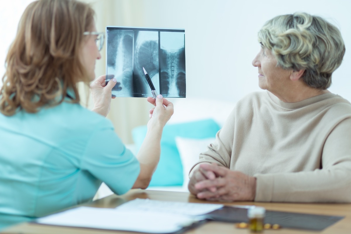 Doctor showing patient scans