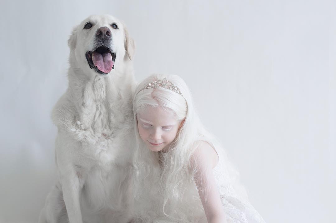 breathtaking-beauty-of-albinos-was-captured-by-a-photographer-02